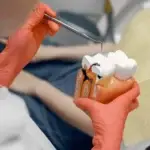 Root Canal Appreciation Day