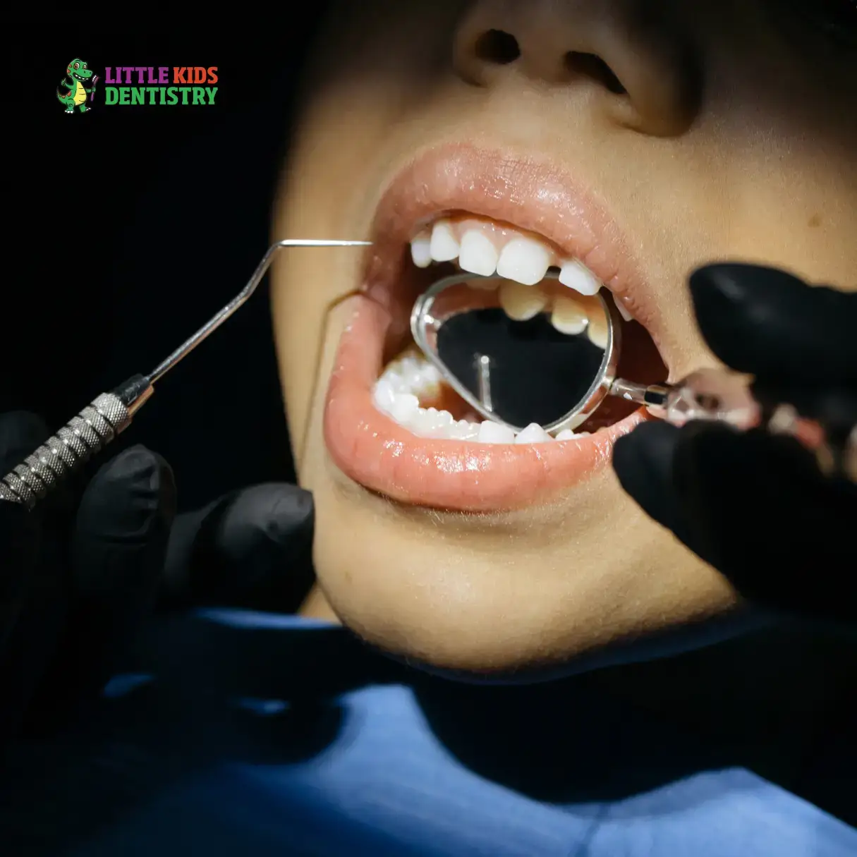 Why Kids' Dentistry is Essential for Healthy Smiles 🦷
