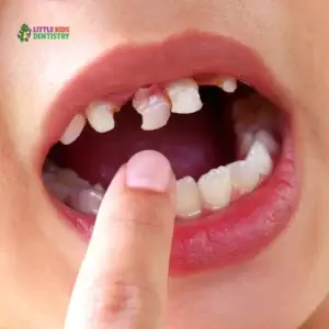 Problemas dentales comunes en los niños y cómo prevenirlos: una guía para padres