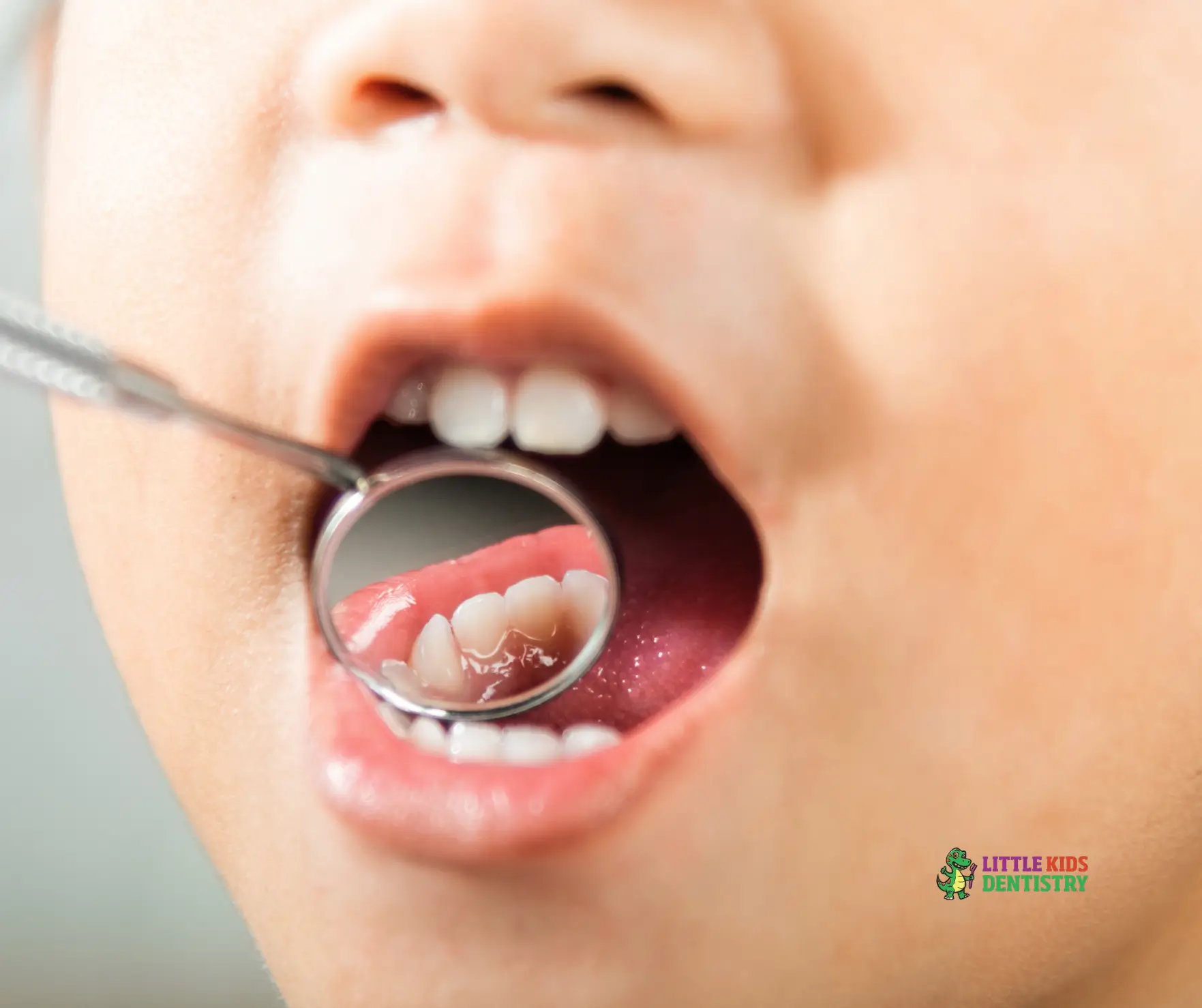 Child at dentist with dental mirror